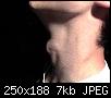     

:	250px-Myneck.jpg
:	15
:	6.7 
:	333541