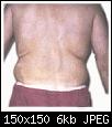     

:	sucking_fat_02_before.jpg
:	17
:	5.7 
:	348746