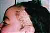 alopecia.jpg‏